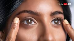 5 Signs Of Ageing Around The Eyes