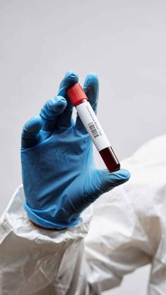 డెంగ్యూ ఫీవర్ - ప్లేట్‌లెట్ల సంఖ్య పెరగాలంటే ఇవి తినండి