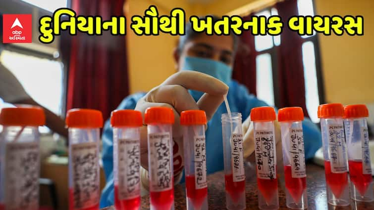 lifestyle These are the world most dangerous virus millions of people have been died Dangerous Virus: આ છે વિશ્વના સૌથી ખતરનાક વાયરસ, લાખો લોકોનો લઈ ચૂક્યા છે ભોગ