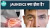 Understanding Jaundice Its Symptoms and Impact on Children, Watch Video To Know More