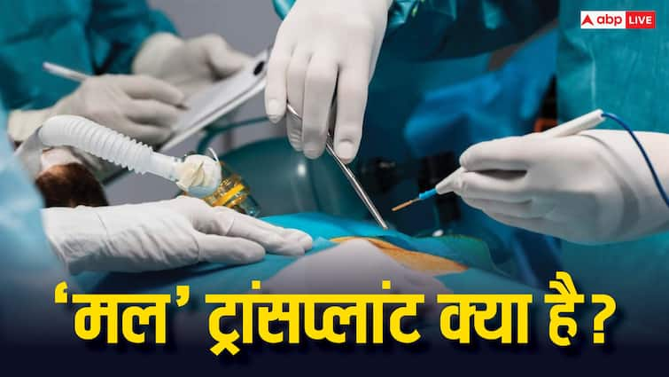 Median arcuate ligament MAL can impair arterial inflow during orthotopic liver transplantation 'मल' ट्रांसप्लांट किस बीमारी में होता है जरूरी? क्या होता है इसका पूरा प्रोसेस?