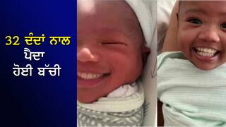 32 ਦੇ 32 ਦੰਦਾਂ ਨਾਲ ਜੰਮਿਆ ਬੱਚਾ, ਡਾਕਟਰ ਵੀ ਰਹਿ ਗਏ ਹੈਰਾਨ, ਦੇਖੋ VIDEO
