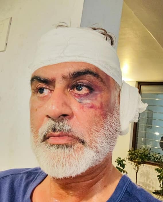 ਤੇਜ਼ਧਾਰ ਹਥਿਆਰਾਂ ਨਾਲ ਲਹੂ-ਲੁਹਾਣ ਕੀਤਾ ਪੰਜਾਬੀ ਕਲਾਕਾਰ, ਖੌਫਨਾਕ Pics Viral