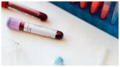 જાણો રક્તદાન કોણે અને ક્યારે ન કરવું જોઈએ, નહીં તો સમસ્યા થઈ શકે છે