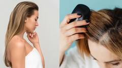 Hair Loss : முடி உதிர்வு பிரச்சினைக்கு பாய் சொல்ல இதை பின்பற்றுங்க மக்களே!