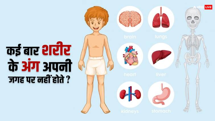 Sometimes why body parts are not in their place Know that case what is the harm caused by this कई बार अपनी जगह पर क्यों नहीं होते शरीर के अंग, इससे क्या होता है नुकसान?