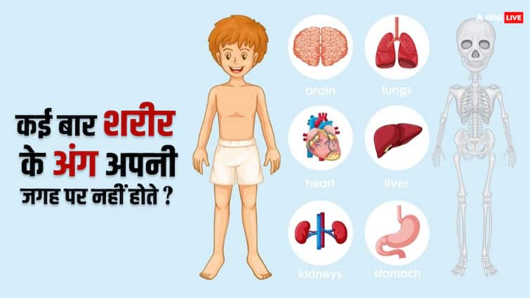 कई बार अपनी जगह पर क्यों नहीं होते शरीर के अंग, इससे क्या होता है नुकसान? Sometimes why body parts are not in their place Know that case what is the harm caused by this कई बार अपनी जगह पर क्यों नहीं होते शरीर के अंग, इससे क्या होता है नुकसान?