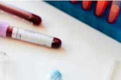 Health: ਇਨ੍ਹਾਂ ਲੋਕਾਂ ਨੂੰ ਨਹੀਂ ਕਰਨਾ ਚਾਹੀਦਾ ਖੂਨਦਾਨ, ਨਹੀਂ ਤਾਂ ਹੋ ਸਕਦੀ ਵੱਡੀ ਪਰੇਸ਼ਾਨੀ