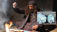 యువతి తలలో 70 పిన్నులు, తాంత్రికుడి దుశ్చర్య - అవాక్కైన డాక్టర్లు!