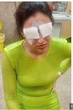 ਮਸ਼ਹੂਰ ਅਦਾਕਾਰਾ ਨੂੰ ਦਿਖਣਾ ਹੋਇਆ ਬੰਦ, ਅੱਖਾਂ 'ਚ ਉੱਠਿਆ ਦਰਦ ਤੇ ਸ਼ੂਰੁ ਹੋਈ ਜਲਣ