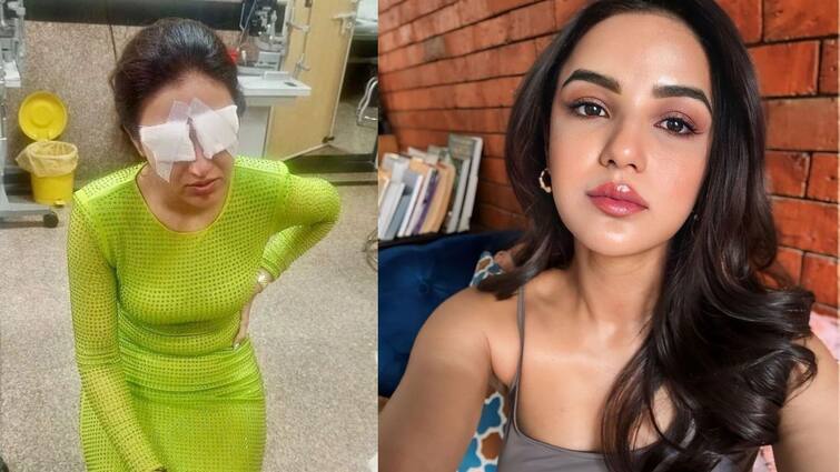 Actress Jasmine Bhasin says her corneas got damaged after she wore lenses is undergoing treatment Jasmine Bhasin: 'যন্ত্রণা হচ্ছে, দেখতে পাচ্ছি না', অভিনেত্রী জসমিন ভাসিনের কর্নিয়ায় ক্ষত, চলছে চিকিৎসা