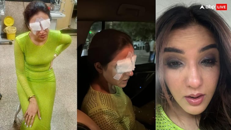 Jasmin Bhasin Lens mishap suffers corneal damage says I can not see properly difficult even to sleep लेंस लगाते ही आंखें हुईं खराब, मशहूर एक्ट्रेस ने कहा- 'मुझे दिखना हुआ बंद, सोने में भी दर्द हो रहा'