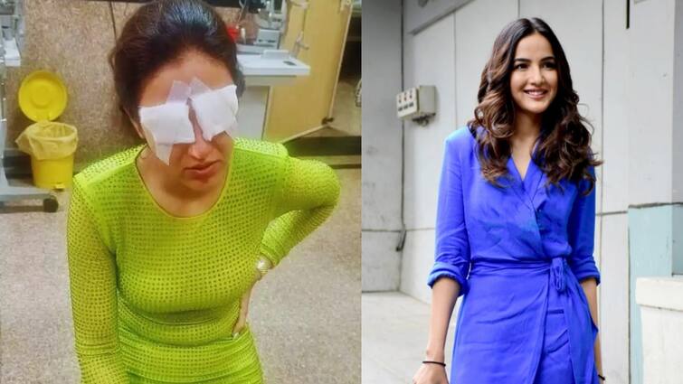 Simbu movie Actress Jasmin bhasin cornea has got affected not able to see sleep Jasmin Bhasin: பார்க்க முடியல... தூங்க முடியல... சரியாக இன்னும் நாலு நாள் ஆகுமாம்... சிம்பு பட நடிகைக்கு கண் பார்வை பாதிப்பு