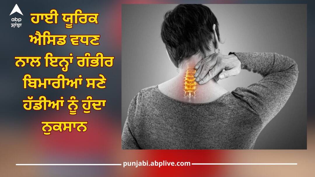 High Uric Acid: ਹਾਈ ਯੂਰਿਕ ਐਸਿਡ ਵਧਣ ਨਾਲ ਇਨ੍ਹਾਂ ਗੰਭੀਰ ਬਿਮਾਰੀਆਂ ਸਣੇ ਹੱਡੀਆਂ ਨੂੰ ਹੁੰਦਾ ਨੁਕਸਾਨ, ਜਾਣੋ ਕਿਵੇਂ ਕਰੀਏ ਬਚਾਅ Increase in high uric acid causes damage to bones with these serious diseases, know how to prevent it health news High Uric Acid: ਹਾਈ ਯੂਰਿਕ ਐਸਿਡ ਵਧਣ ਨਾਲ ਇਨ੍ਹਾਂ ਗੰਭੀਰ ਬਿਮਾਰੀਆਂ ਸਣੇ ਹੱਡੀਆਂ ਨੂੰ ਹੁੰਦਾ ਨੁਕਸਾਨ, ਜਾਣੋ ਕਿਵੇਂ ਕਰੀਏ ਬਚਾਅ