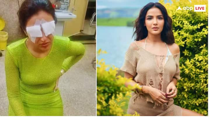 Jasmin Bhasin की आंखें कलर्ड कॉस्ट्यूम लेंस से डैमेज हो गईं, जिससे उन्हें काफी परेशानी हुई. अगर आप भी कलर्ड लेंस लगाने की सोच रहे हैं, तो कुछ जरूरी सावधानियां बरतें होंगे.