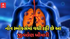Alert: નોન સ્મોકર્સમાં વધી રહ્યો છે Lung Cancer નો ખતરો, જાણો આ જીવલેણ બીમારી માટે કયા કારણ છે જવાબદાર
