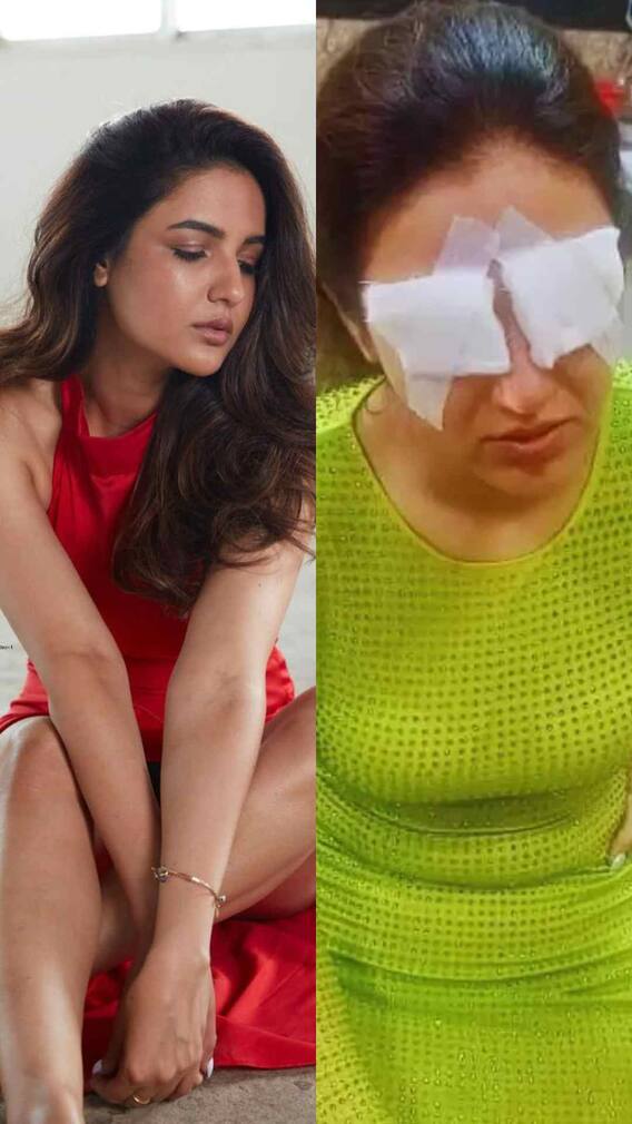 आंख खराब होने से लेकर सुसाइड तक इस हसीना ने झेले कई दर्द