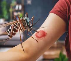 Dengue Treatment: ਕੀ ਡੇਂਗੂ ਹੋਣ ਤੋਂ ਬਾਅਦ ਹਸਪਤਾਲ 'ਚ ਭਰਤੀ ਹੋਣਾ ਜ਼ਰੂਰੀ? ਜਾਣੋ ਕੀ ਕਹਿੰਦੇ ਮਾਹਿਰ