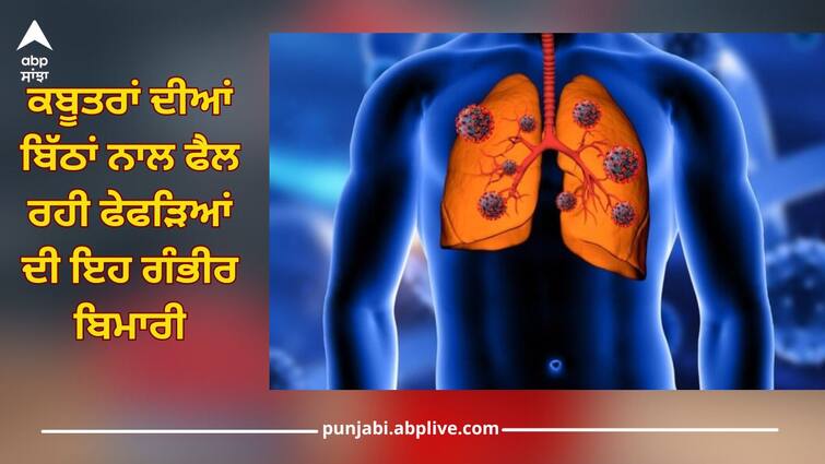 This serious lung disease spreading with pigeon litter, know its symptoms and prevention Lung Disease: ਕਬੂਤਰਾਂ ਦੀਆਂ ਬਿੱਠਾਂ ਨਾਲ ਫੈਲ ਰਹੀ ਫੇਫੜਿਆਂ ਦੀ ਇਹ ਗੰਭੀਰ ਬਿਮਾਰੀ, ਜਾਣੋ ਇਸ ਦੇ ਲੱਛਣ ਅਤੇ ਬਚਾਅ