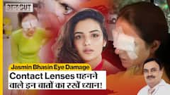 Jasmin Bhasin Eye Damage | Contact Lenses पहनने वाले लोग इन बातों का ज़रूर रखें ध्यान | Uncut