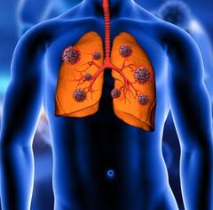 Health News: ਕਬੂਤਰਾਂ ਤੋਂ ਹੋ ਰਹੀ ਫੇਫੜਿਆਂ ਸੰਬੰਧੀ ਖਤਰਨਾਕ ਬਿਮਾਰੀ, ਲੱਛਣ ਪਛਾਣ ਕੇ ਇੰਝ ਕਰੋ ਬਚਾਅ