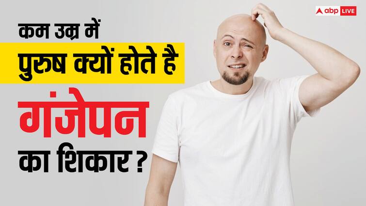 What is the main cause of hair baldness in male Hair Loss: पुरुषों में कम उम्र में ही क्यों होता है गंजापन, जानें किस चीज की हो जाती है कमी