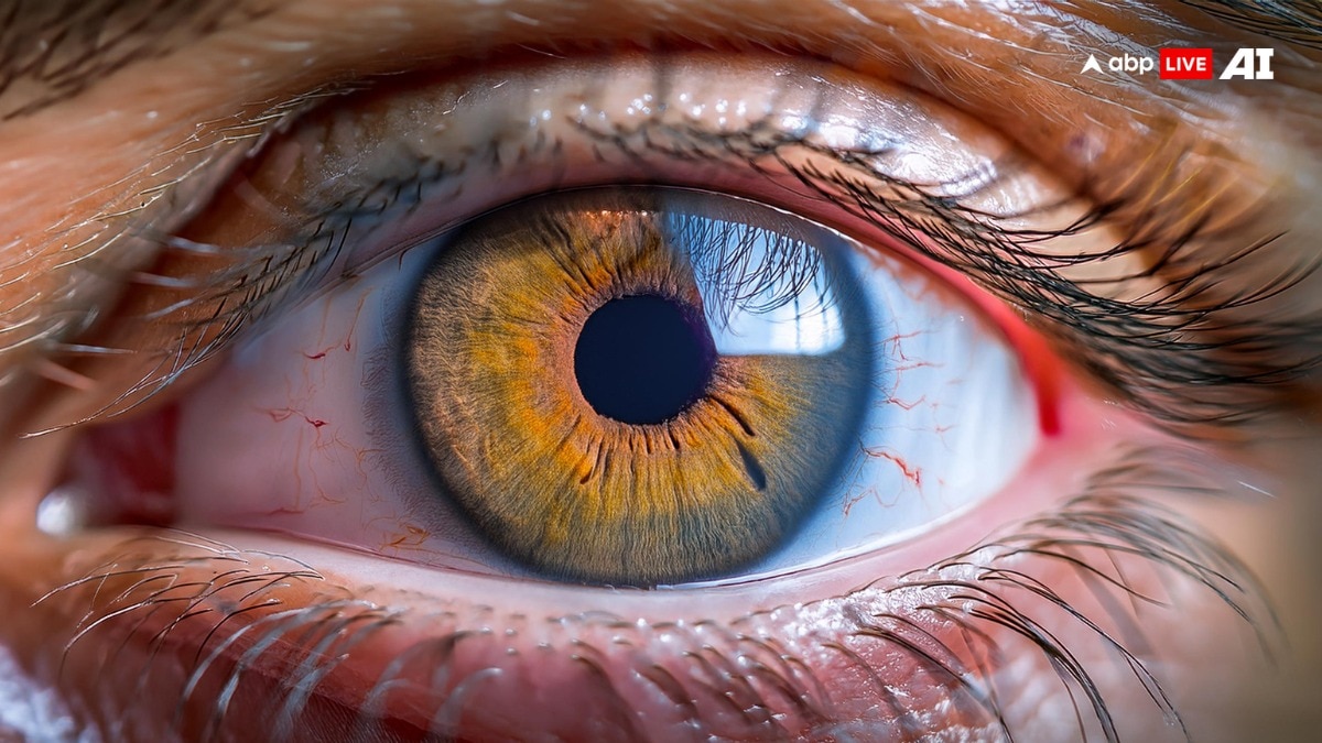 Diabetic Macular Edema Explained: Symptoms, Causes, Diagnosis, Treatment- All You Need To Know