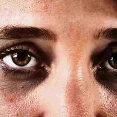 Eyes Care : ਕਾਂਟੈਕਟ ਲੈਂਸ ਪਹਿਨਣ ਵੇਲੇ ਵਰਤੋਂ ਸਾਵਧਾਨੀ, ਰਹੋ ਸੁਚੇਤ