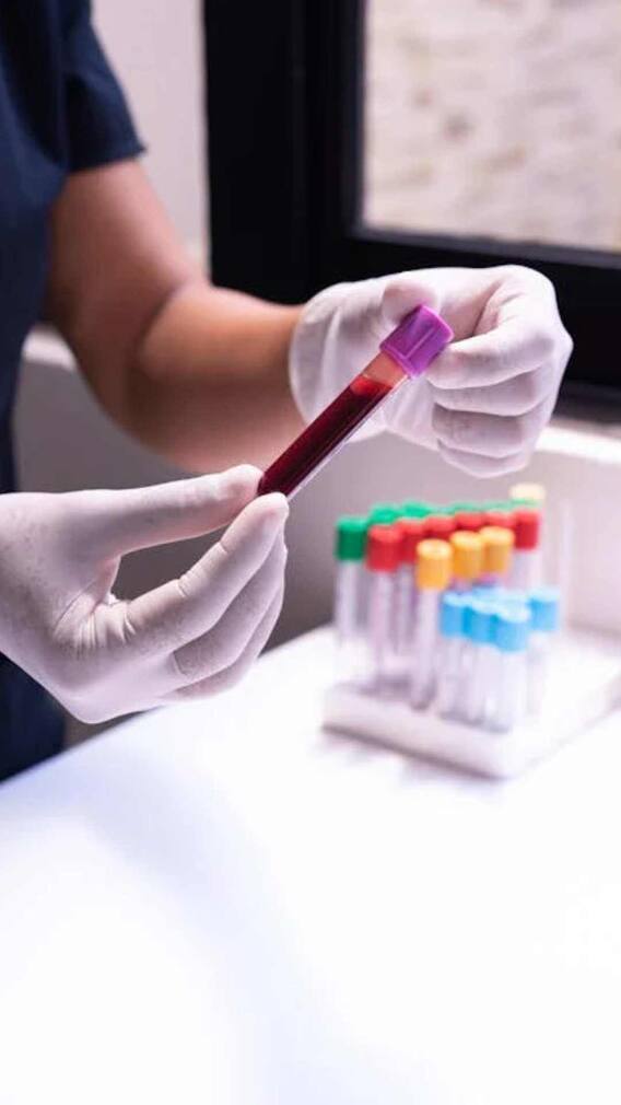 రక్తహీనతను తరిమి కొట్టాలంటే ఈ జ్యూస్ తీసుకోండి!