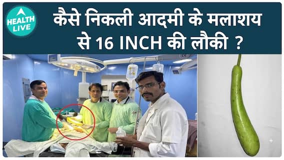 Doctors extracted 16-inch bottle gourd from man's rectum | Health LIVE