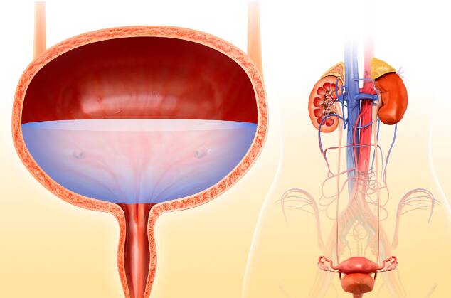 Patients with almost all types of cancer experience loss of appetite. In the advanced stage of bladder cancer, the patient also stops feeling hungry, due to which he starts facing many other problems. Mainly the patients start losing a lot of weight. If your weight is decreasing rapidly without any reason, then consult a specialist.