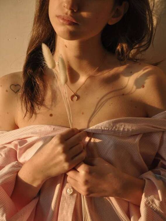 शरीर पर कैसे आ जाते हैं तिल?