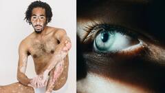 Ayurvedic Food : சருமம் முதல் கண் வரை..ஆரோக்கியத்தை காக்கும் மூலிகை பொடிகள்!