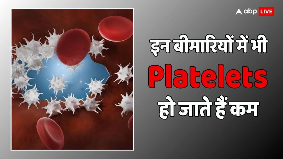 health tips what is immune thrombocytopenic disease know causes symptoms and prevention in Hindi Platelet Count: डेंगू ही नहीं इस बीमारी में भी कम हो जाती हैं प्लेटलेट्स, ये हैं लक्षण