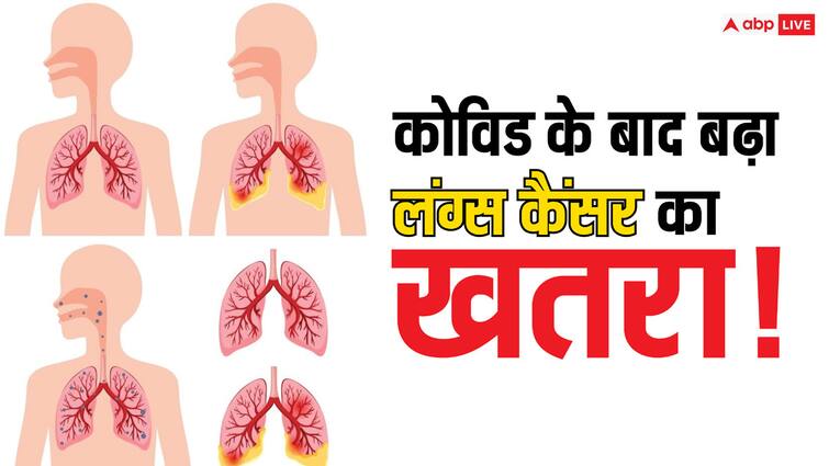 study finds high rate of lung damage in Indians after acute COVID 19 read full article in hindi World Lung Cancer Day: क्या कोविड के बाद बढ़ गए लंग्स कैंसर के मामले, महामारी से कितना पड़ा असर?