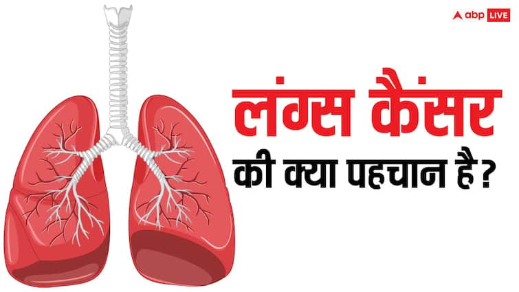 world lung cancer day 2024 common signs and symptoms of lung cancer such as a worsening cough and loss of appetite World Lung Cancer Day 2024: ये पांच लक्षण दिखें तो समझ जाएं हो गया है लंग कैंसर, भूलकर भी न करें इग्नोर