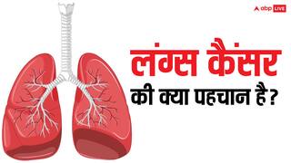World Lung Cancer Day 2024: ये पांच लक्षण दिखें तो समझ जाएं हो गया है लंग कैंसर, भूलकर भी न करें इग्नोर