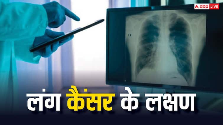 world lung cancer day 2024 has been observed every year on 1 August How many people die every year World Lung Cancer Day 2024:  स्मोकिंग करने से हर साल कितने लोगों को होता है लंग कैंसर?