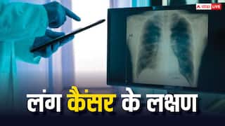 World Lung Cancer Day 2024:  स्मोकिंग करने से हर साल कितने लोगों को होता है लंग कैंसर?