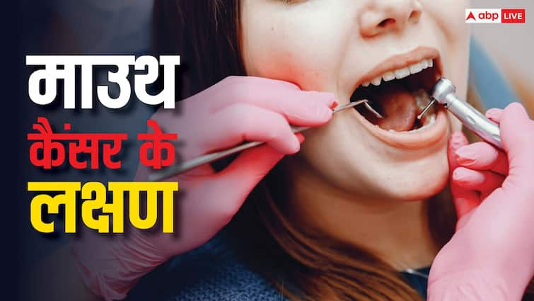 health tips mouth cancer causes symptoms prevention in hindi Mouth Cancer: कैसे और किन वजहों से होता है माउथ कैंसर? जानें क्या होते हैं इसके लक्षण