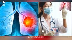 Lung Cancer: ਬਿਨਾਂ ਸਿਗਰਟ ਪੀਏ ਕਿਉਂ ਹੋ ਰਹੇ ਨੇ ਲੋਕ ਲੰਗ ਕੈਂਸਰ ਦੇ ਸ਼ਿਕਾਰ? ਇਹ ਰਹੇ ਵੱਡੇ ਕਾਰਨ