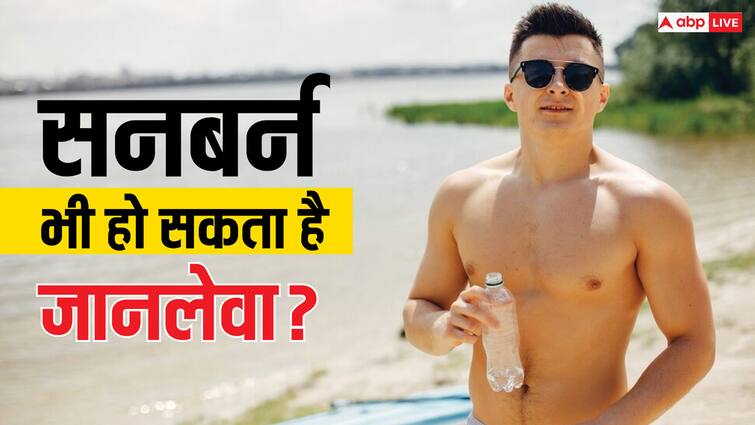 can you survive if your heart stops for 20 minutes सनबर्न से 25 मिनट तक नहीं धड़का इस युवक का दिल, जानें क्या है यह बीमारी?