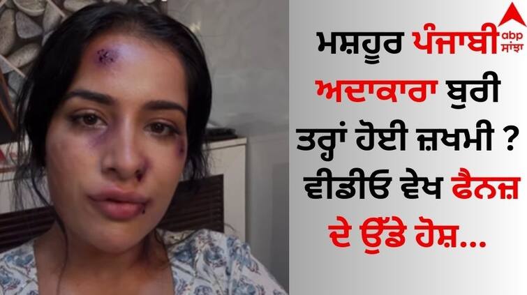 Famous Punjabi actress sara gurpal badly injured? Seeing the video, the fans were blown away Punjabi Actress: ਮਸ਼ਹੂਰ ਪੰਜਾਬੀ ਅਦਾਕਾਰਾ ਬੁਰੀ ਤਰ੍ਹਾਂ ਹੋਈ ਜ਼ਖਮੀ ? ਵੀਡੀਓ ਵੇਖ ਫੈਨਜ਼ ਦੇ ਉੱਡੇ ਹੋਸ਼