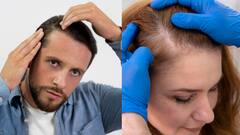 Hair Fall : தலை முடி அதிகமா உதிர்கிறதா? உங்களுக்கான வீட்டு வைத்தியம் இதோ!