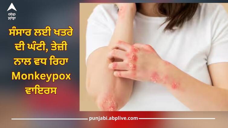 monkeypox virus spreading fast in africa how dangerous is it health news ਸੰਸਾਰ ਲਈ ਖਤਰੇ ਦੀ ਘੰਟੀ, ਤੇਜ਼ੀ ਨਾਲ ਵਧ ਰਿਹਾ Monkeypox ਵਾਇਰਸ