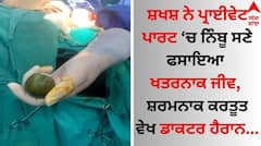 Shocking: ਸ਼ਖਸ਼ ਵੱਲੋਂ ਸ਼ਰਮਨਾਕ ਕਰਤੂਤ, ਡਾਕਟਰਾਂ ਨੇ ਪ੍ਰਾਈਵੇਟ ਪਾਰਟ 'ਚੋਂ ਕੱਢੀ ਅਜਿਹੀ ਚੀਜ਼..ਉੱਡ ਗਏ ਹੋਸ਼