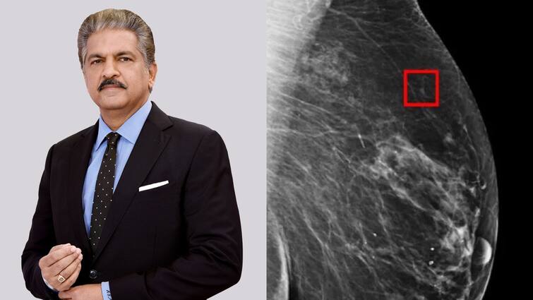 Cancer can be detected 5 years before it develops says Anand Mahindra on AI X Post 'कैंसर डेवलप होने से 5 साल पहले चल जाएगा पता...',  AI को लेकर आनंद महिंद्रा का बड़ा बयान