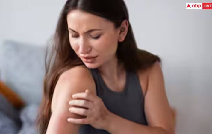 ਇੱਕ ਆਮ ਇਨਸਾਨ ਵਿੱਚ 3-4 ਲੱਖ ਪਲੇਟਲੈਟਸ ਹੁੰਦੇ ਹਨ। ਪਰ ਡੇਂਗੂ ਦੇ ਮਰੀਜ਼ ਦੇ ਪਲੇਟਲੈਟਸ ਅਚਾਨਕ ਘਟਣੇ ਸ਼ੁਰੂ ਹੋ ਜਾਂਦੇ ਹਨ। ਜੇਕਰ ਡੇਂਗੂ ਦੇ ਮਰੀਜ਼ ਦੇ ਪਲੇਟਲੈਟਸ 1 ਲੱਖ ਤੋਂ 50 ਹਜ਼ਾਰ ਤੱਕ ਪਹੁੰਚ ਜਾਂਦੇ ਹਨ ਤਾਂ ਇਹ ਮਰੀਜ਼ ਲਈ ਚਿੰਤਾ ਦਾ ਵਿਸ਼ਾ ਹੈ। ਮਰੀਜ਼ ਦੀ ਗੰਭੀਰ ਹਾਲਤ ਉਦੋਂ ਹੁੰਦੀ ਹੈ ਜਦੋਂ ਮਰੀਜ਼ ਦੇ ਪਲੇਟਲੈਟਸ 10 ਹਜ਼ਾਰ ਤੱਕ ਡਿੱਗ ਜਾਂਦੇ ਹਨ।