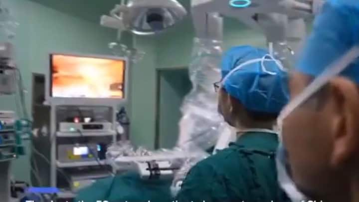 चीन के एक अस्पताल में बड़ा कारनामा कर डाला है. सर्जन मरीज से 5000 किलोमीटर दूर था. उसके बावजूद भी उसने अपने मरीज के फेफड़ों में से ट्यूमर सफलतापूर्वक बाहर निकाला. इसका वीडियो सोशल मीडिया पर खूब वायरल हो रहा है.