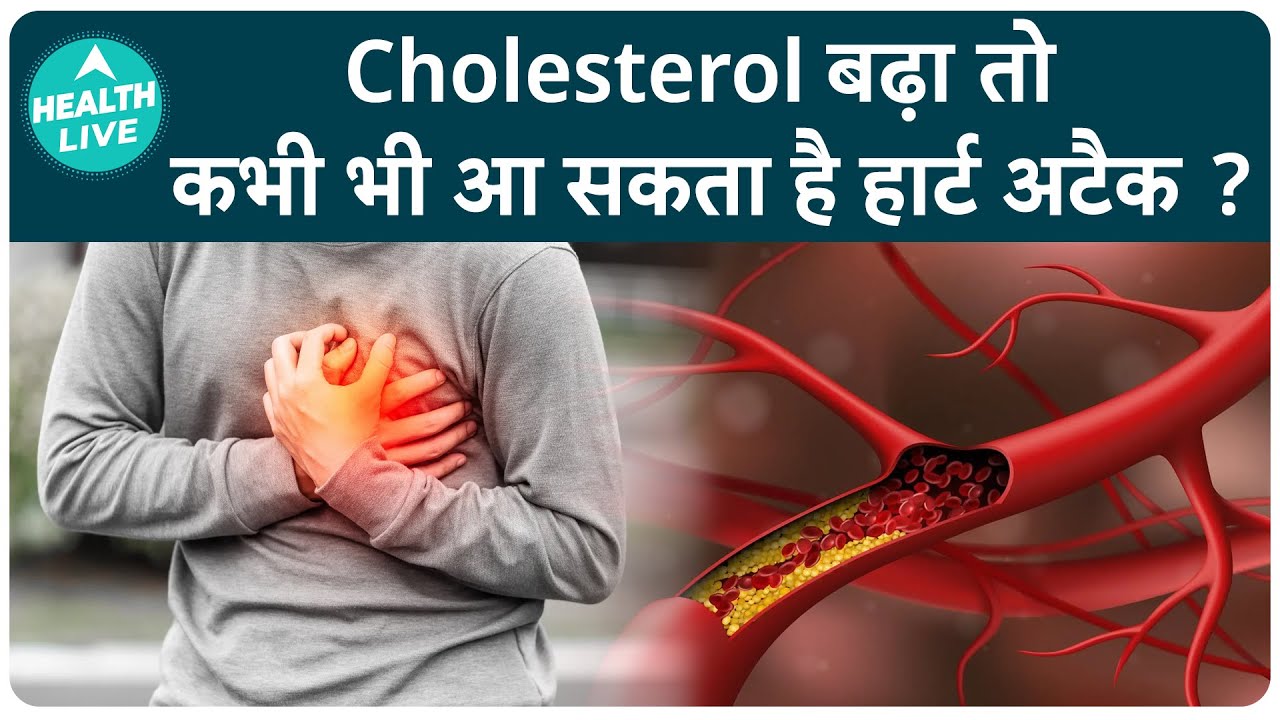 Rising Cholesterol Levels Could Lead To Heart Attack | Health Live